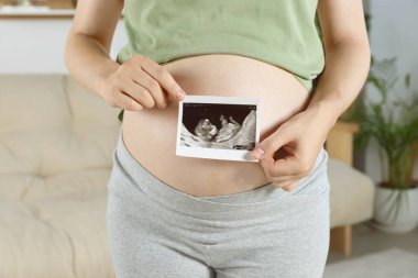 Oturma odasında ultrason fotoğrafı olan hamile kadın, yakın plan.