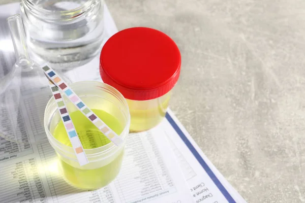 stock image Containers with urine samples for analysis, glassware and test forms on grey table, above view. Space for text