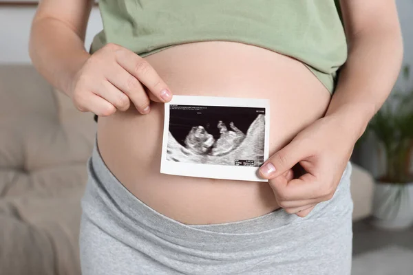 Беременная Женщина Ультразвуковым Снимком Ребенка Гостиной Крупный План — стоковое фото