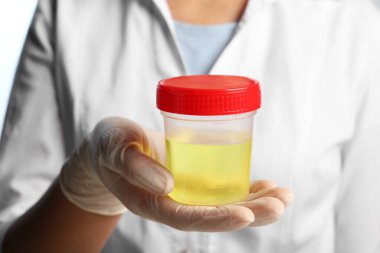 Doctor holding container with urine sample for analysis, closeup clipart