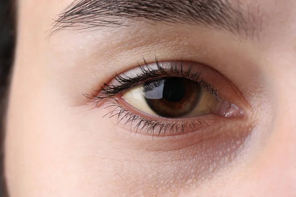 Woman Yellow Eyes Closeup Symptom Hepatitis — Stock Photo, Image