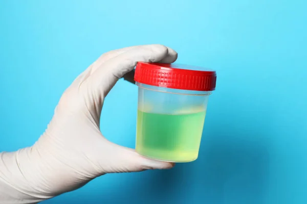Médecin Portant Récipient Gants Avec Échantillon Urine Pour Analyse Sur — Photo
