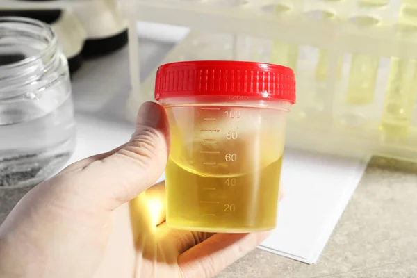 Dokter Memegang Wadah Dengan Sampel Urin Untuk Analisis Meja Abu — Stok Foto