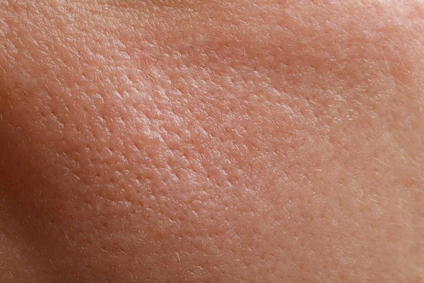 人間の脂性肌を背景としたクローズアップ — ストック写真
