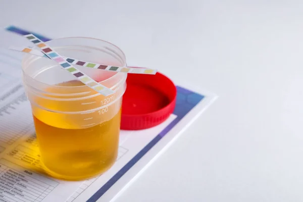 Behälter Mit Urinprobe Zur Analyse Und Teststreifen Auf Weißem Tisch — Stockfoto
