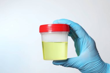 Doctor holding container with urine sample for analysis on white background, closeup clipart