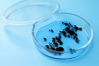 Açık mavi zemin üzerinde bakteri kolonisi olan petri kabı