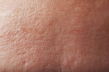 Arkaplan olarak insan derisinin yakın görüntüsü