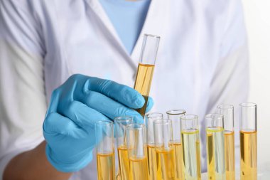 Hemşire tüpü idrar örneğiyle birlikte beyaz arka plan üzerinde analiz için tutuyor.