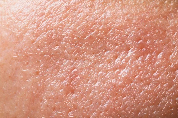 Closeup view of human oily skin as background