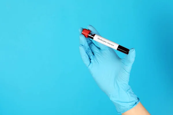 Monkeypox virus diagnosis. Laboratory worker holding test tube with blood sample on light blue background, closeup and space for text