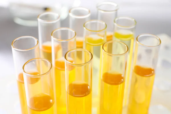 Tubes Urine Samples Analysis Blurred Background Closeup — Stock Photo, Image