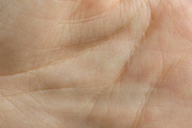 Kuru ciltli insan elinin yakın görüntüsü