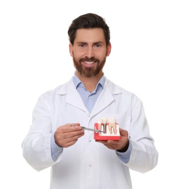 Diş hekimi beyaz arka planda diş implantının eğitim modelini tutuyor