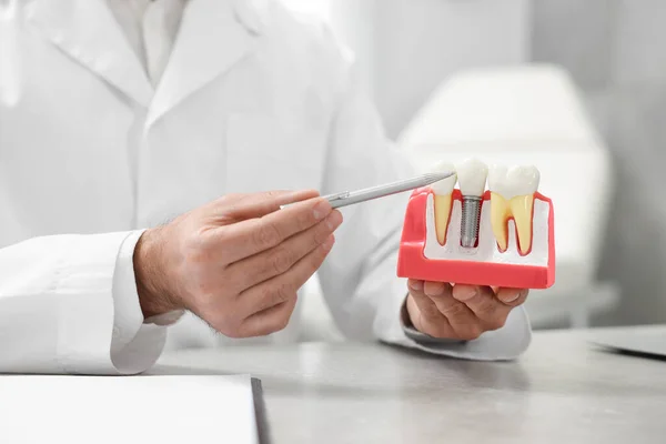 Doctor showing educational model of dental implant in clinic, closeup