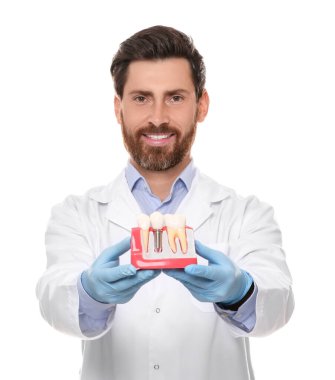 Diş hekimi beyaz arka planda diş implantının eğitim modelini tutuyor