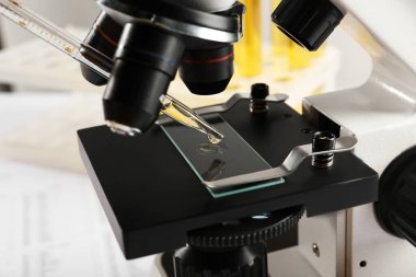 Laboratuvarda cam kaydırağında sidik damlası olan mikroskop, yakın plan.