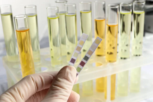 stock image Nurse holding tube with urine sample for analysis on light grey background, closeup