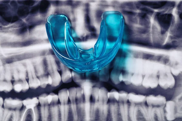 Mouth guard on dental scan, top view. Bite correction