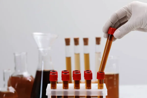 Scientist taking test tube with brown liquid from stand against light background, closeup