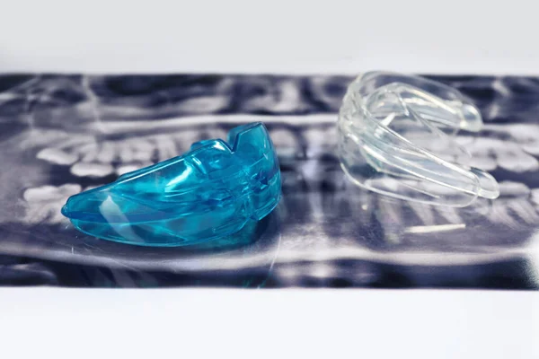 Mouth guards on dental scan. Bite correction
