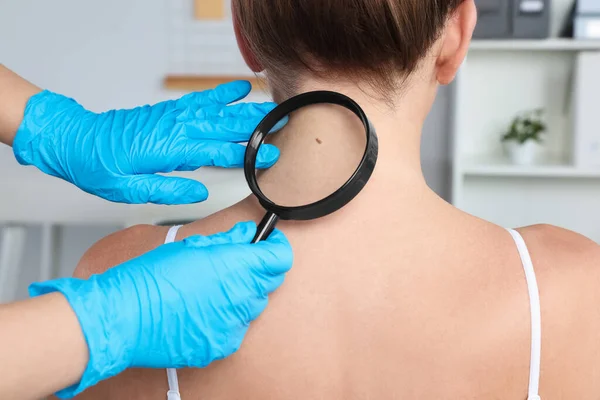 Dermatologista Examinando Marca Nascença Paciente Com Lupa Clínica Close — Fotografia de Stock