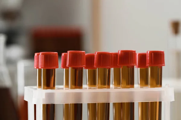 Test tubes with brown liquid in stand, closeup