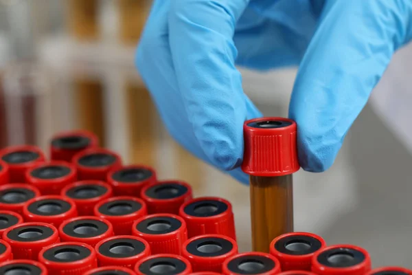 Scientist taking test tube with brown liquid from stand, closeup