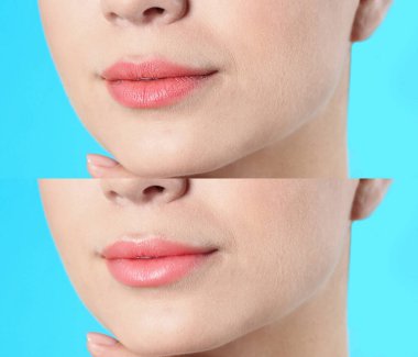 Açık mavi arka planda dudak kremi kullanmadan önce ve sonra çekilmiş kadın fotoğraflarıyla kolaj, yakın plan