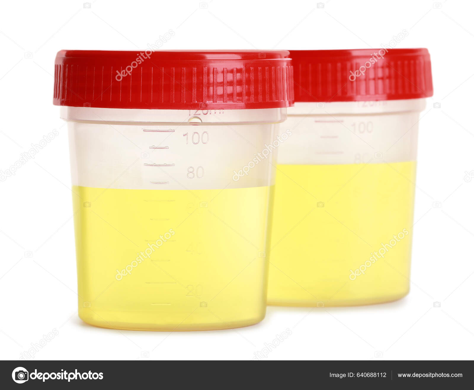 Containers Urine Samples Analysis White Background — Stock-foto © NewAfrica  #640688112