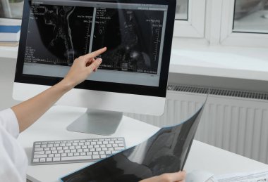 Doctor examining neck MRI image on computer in clinic, closeup