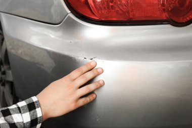 Man near car with scratch, closeup view