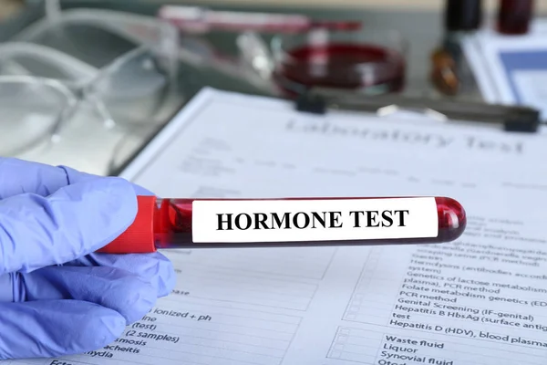 stock image Doctor holding glass tube with blood sample and label Hormone Test at table, closeup