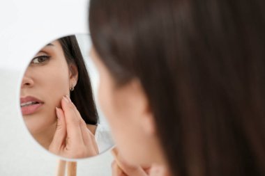 İçerideki sivilcelerinde aynaya bakan genç bir kadın. Hormonal bozukluklar