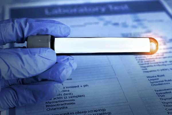 Laboratóriumi Dolgozó Kémcsővel Vérmintával Orvosi Lapon Közelről Színes Tónus — Stock Fotó