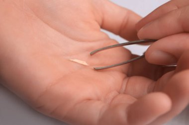 Kadın beyaz arka planda cımbız kullanarak parmağından kıymık çıkartıyor.