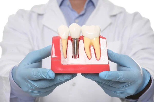 Zahnarzt Hält Ausbildungsmodell Des Zahnimplantats Auf Weißem Hintergrund Nahaufnahme — Stockfoto