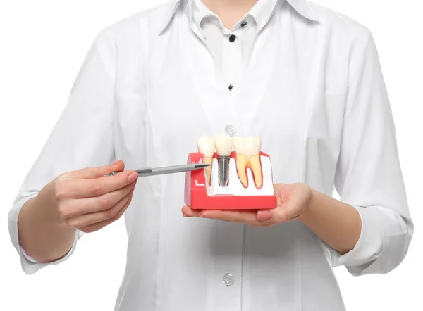 stock image Dentist holding educational model of dental implant on white background, closeup