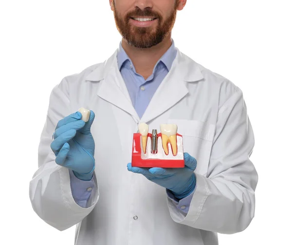 Dentist Holding Educational Model Dental Implant White Background Closeup — Stockfoto