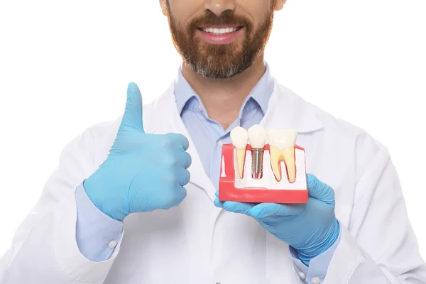 Zubař Drží Vzdělávací Model Zubního Implantátu Bílém Pozadí Detailní Záběr — Stock fotografie