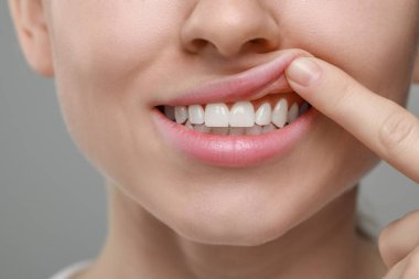 Gri arka planda sağlıklı diş etleri gösteren kadın, yakın plan.