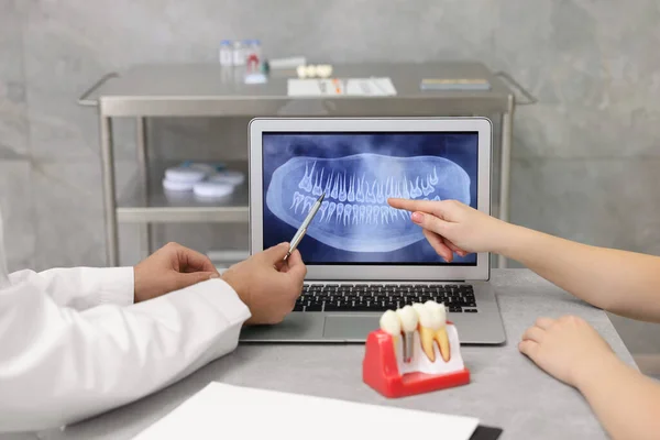 Médico Mostrando Imagem Radiológica Paciente Modelo Educacional Implante Dentário Clínica — Fotografia de Stock