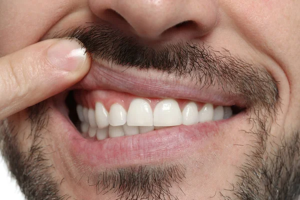 Mann Zeigt Gesundes Zahnfleisch Auf Weißem Hintergrund Nahaufnahme — Stockfoto