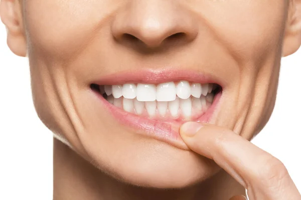 Beyaz Arka Planda Sağlıklı Diş Etleri Gösteren Kadın Yakın Plan — Stok fotoğraf