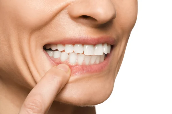 Frau Zeigt Gesundes Zahnfleisch Auf Weißem Hintergrund Nahaufnahme — Stockfoto