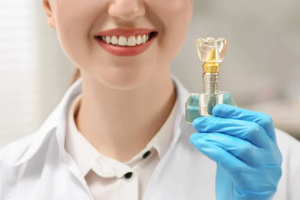 Dentista Segurando Modelo Educacional Implante Dentário Dentro Casa Close — Fotografia de Stock