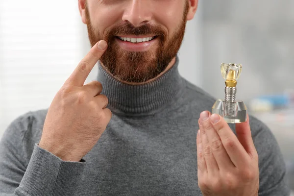 Man Met Educatief Model Van Tandheelkundig Implantaat Wazige Achtergrond Close — Stockfoto