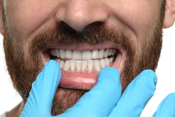 Mann Zeigt Gesundes Zahnfleisch Auf Weißem Hintergrund Nahaufnahme — Stockfoto