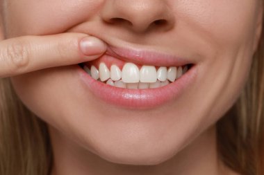 Young woman showing healthy gums, closeup view clipart