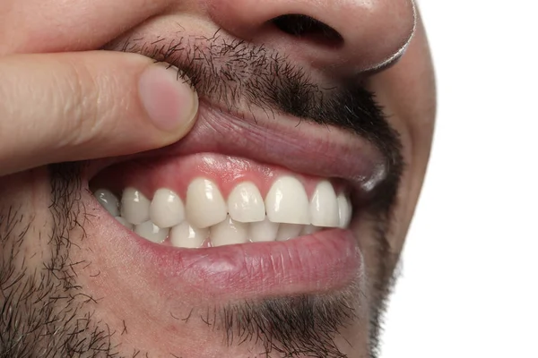 Man Showing Healthy Gums White Background Closeup — Stock Photo, Image